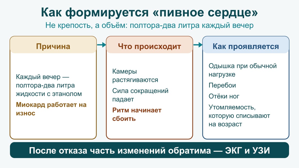 Схема «пивного сердца»: ежевечерние 1,5–2 литра с этанолом — камеры растягиваются, ритм сбоит — одышка, перебои, отёки ног